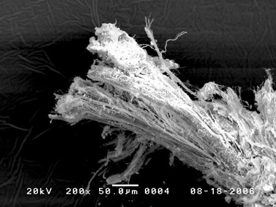 Asbestos fibres